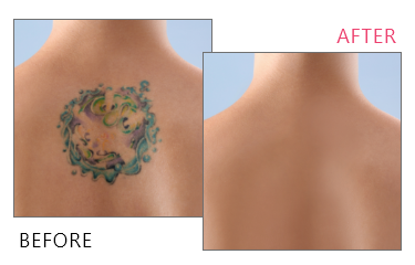 before, after