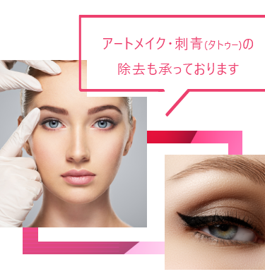 アートメイク・刺青の除去も承っております